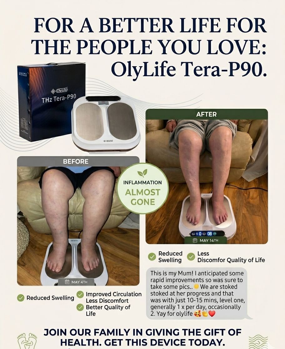 Before and after leg swelling reduction